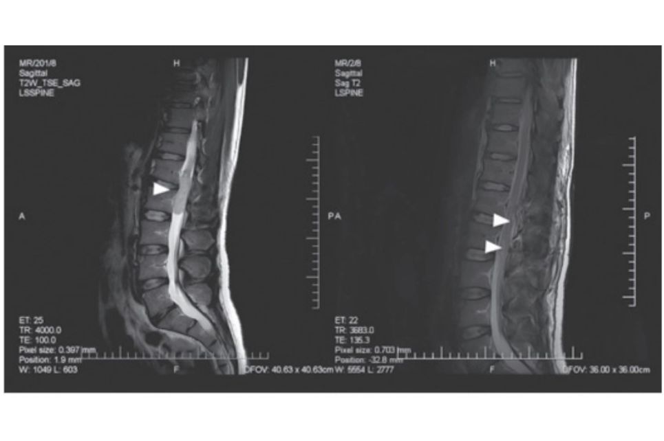 Hlavní obrázek - Screening funkce svalů pánevního dna a prevalence dysmenorey u žen